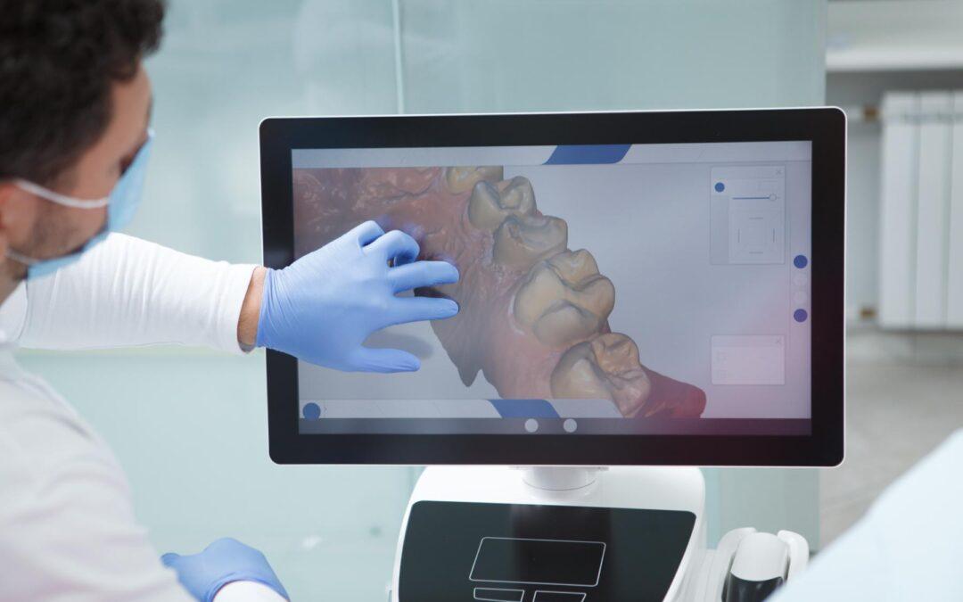 Escáner digital dental en Logroño: así cambia el diagnóstico bucodental